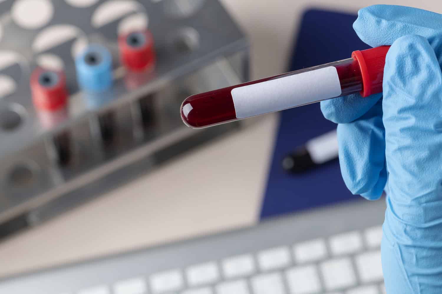 Flomics, la startup que puede detectar 5 tipos de cáncer de forma precoz con un test de sangre